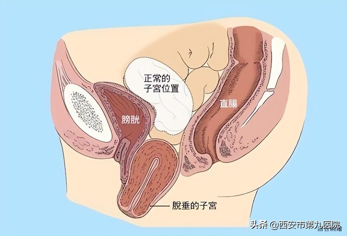 睪丸下垂松弛的原因及治療方法，睪丸下垂松弛的原因與治療方法解析