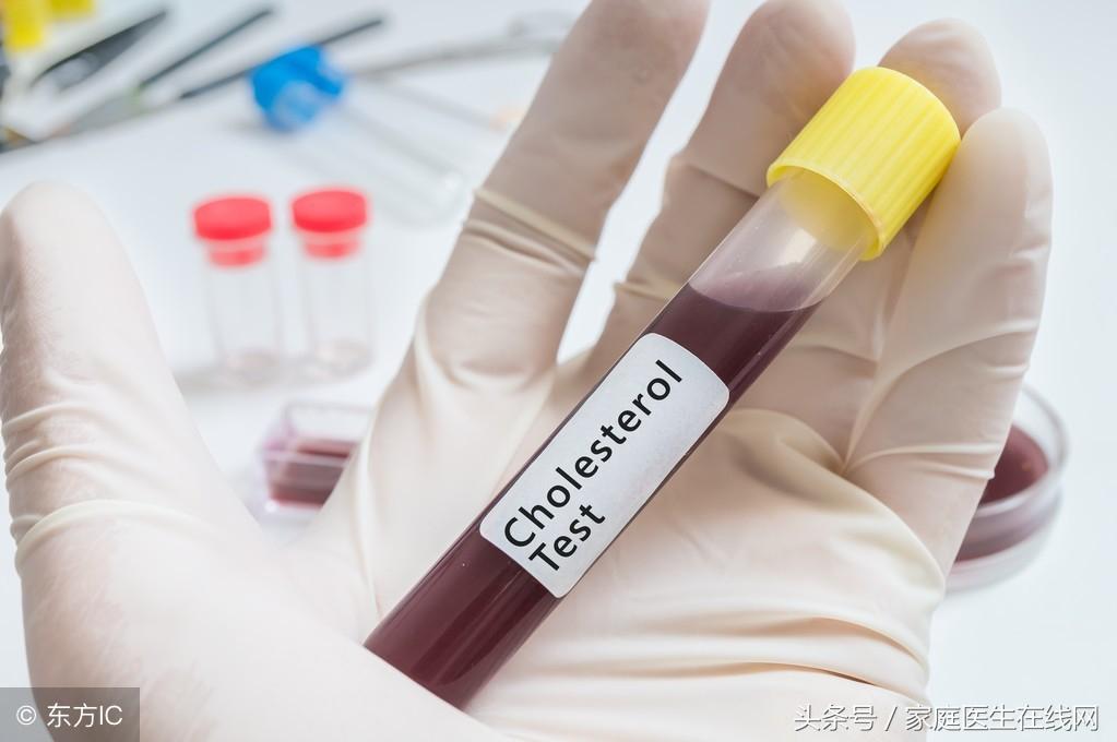 糖尿病的成因，深度解析其背后的原因，深度解析糖尿病成因，揭示背后原因真相