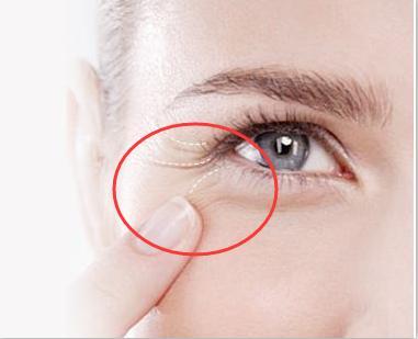 如何去除魚尾紋，最佳方法與實(shí)用建議，去除魚尾紋，最佳方法與實(shí)用建議攻略