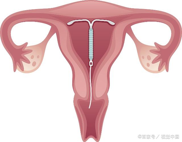 常見(jiàn)八種陰型照片及其特點(diǎn)解析，常見(jiàn)八種陰型照片特點(diǎn)深度解析