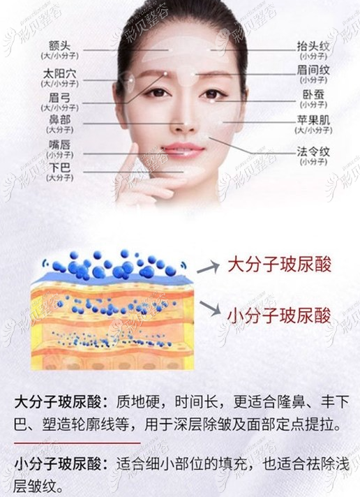 玻尿酸的作用與功效，深入了解玻尿酸的奧秘，玻尿酸的作用與功效揭秘，深入了解玻尿酸的神奇之處