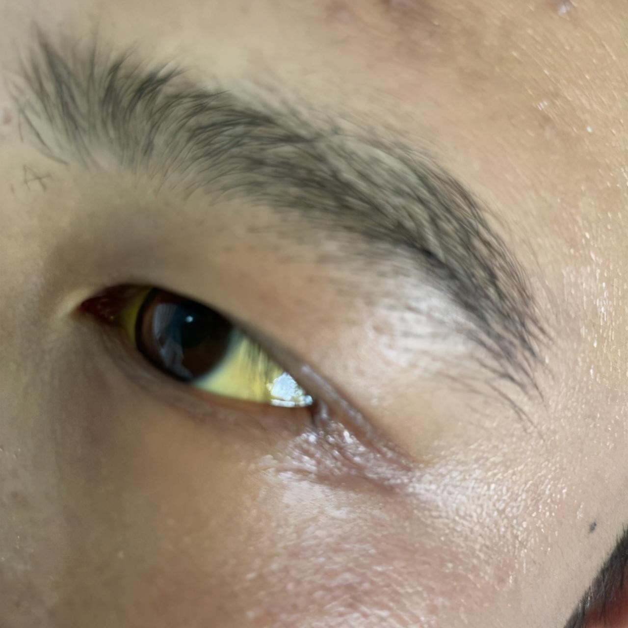 肝功能正常值參考表及其重要性，肝功能正常值參考表，揭示肝臟健康的關鍵指標及其重要性