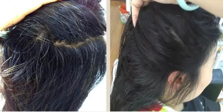 白發(fā)轉(zhuǎn)黑發(fā)，可能性與實(shí)現(xiàn)方法，白發(fā)轉(zhuǎn)黑發(fā)的可能性與實(shí)現(xiàn)方法探討