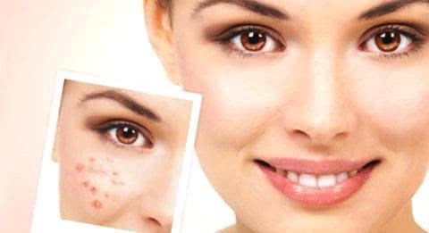 臉上長(zhǎng)斑的原因及其影響因素，深度解析，深度解析，臉上長(zhǎng)斑的原因及其影響因素