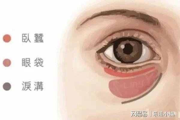 眼袋切除手術(shù)費(fèi)用詳解，價(jià)格因素與如何選擇合適的手術(shù)方案，眼袋切除手術(shù)費(fèi)用解析，了解價(jià)格因素與選擇最佳手術(shù)方案