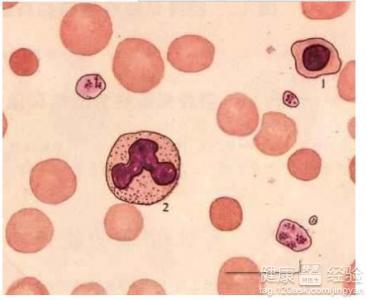 地中海貧血能生小孩嗎，全面理解與生育決策，地中海貧血患者的生育決策，全面理解與探討